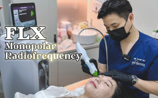 thermage treatment singapore